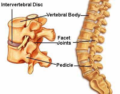 Herniated Discs - Midwest Orthopedic Consultants